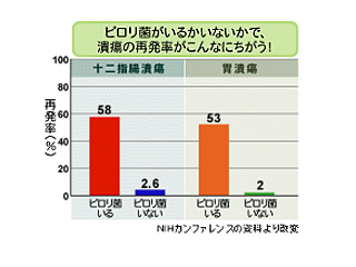 胃潰瘍・十二指腸潰瘍の原因
