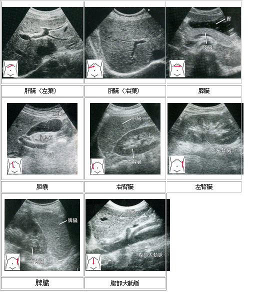 腹部超音波検査｜いしぐろ内科｜一宮市本町の内科、消化器内科、小児科 ...